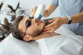 Depilación láser masculina: precisión facial y control en zonas específicas