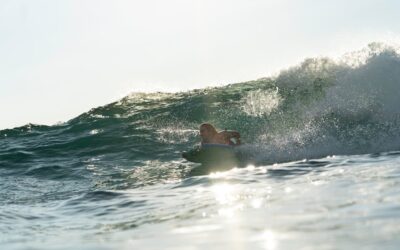 Hilos Tensores en Granada: La Arquitectura del Rejuvenecimiento Facial